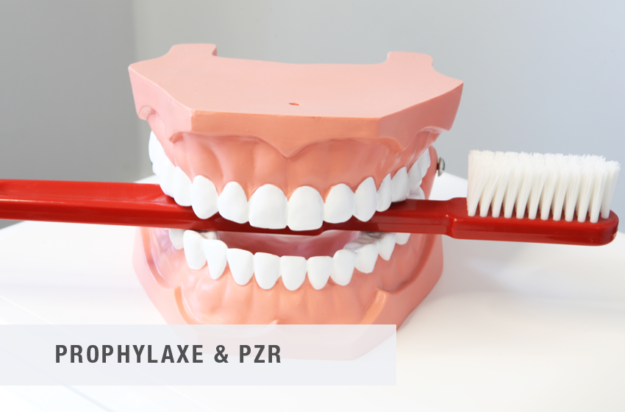Prophylaxe und PZR Stade