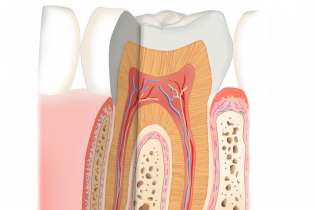 Zahnwurzelbehandlung vom Profi in Stade