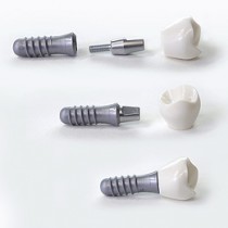 Implantologie in Stade und Umgebung