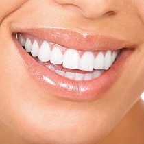 Implantate in Dortmund